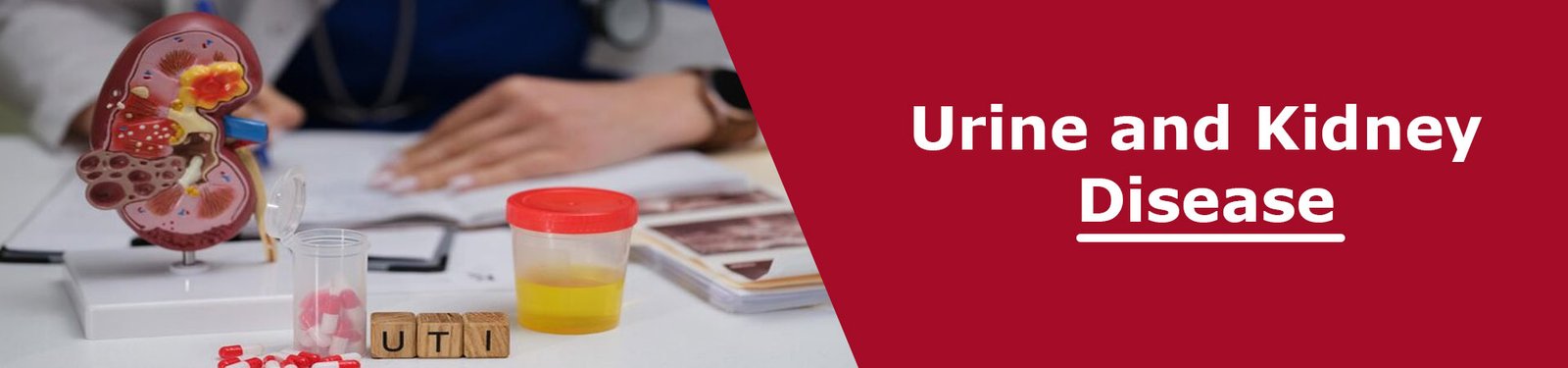 Urine and Kidney Disease